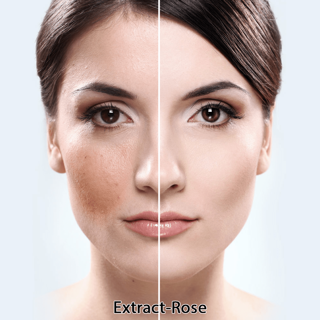 ?8250 Extract-Rose (สารสกัดดอกกุหลาบ)